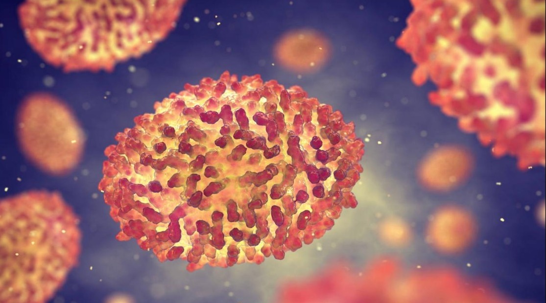 Confirman 2 casos de Viruela Mono en Ciudad Juárez