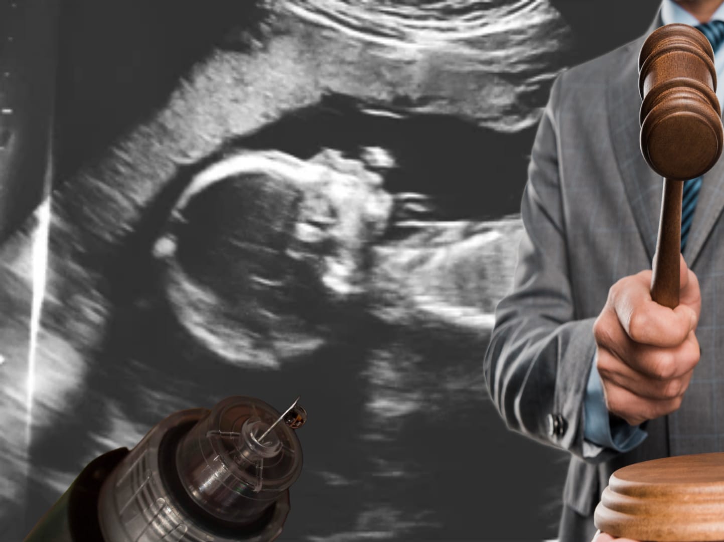 La despenalización del aborto también es avanzar en derechos humanos