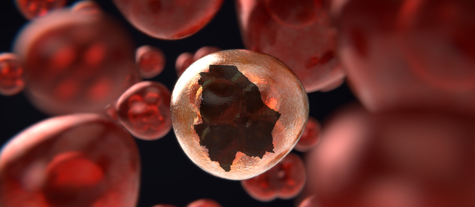 Chihuahua: 5to estado con mayor mortandad por cáncer