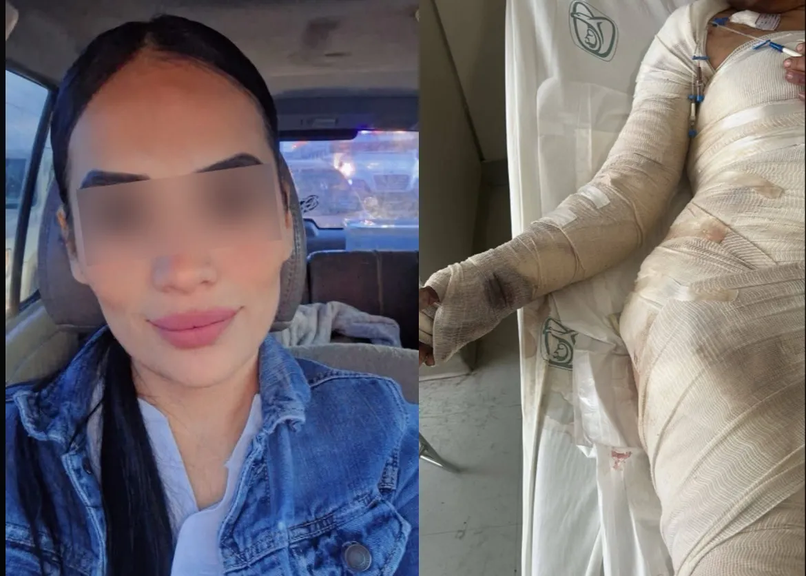 La citó para comprarle un micro… y la prendió en llamas