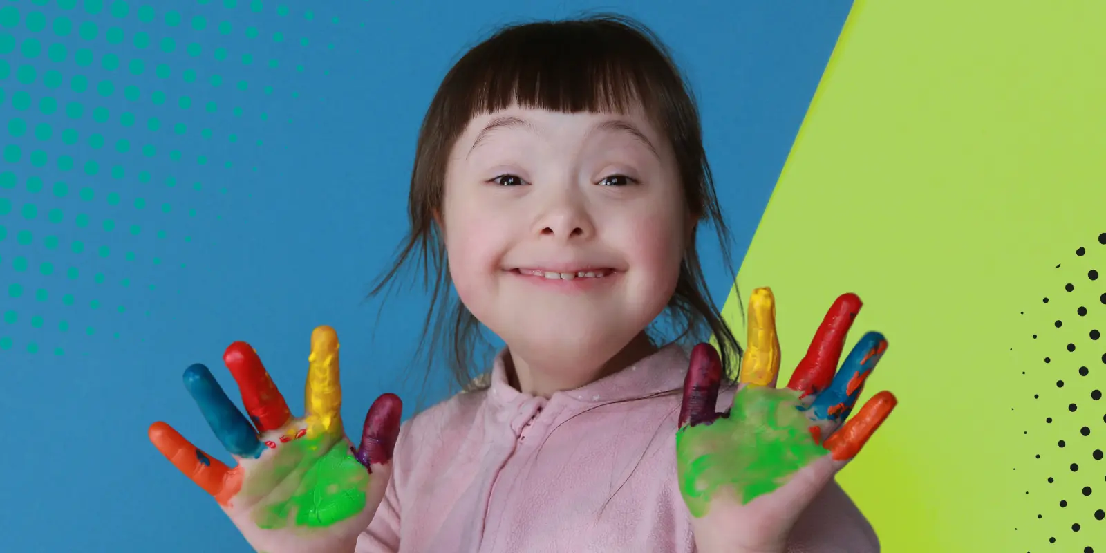 Crearán base de datos para personas con Síndrome de Down